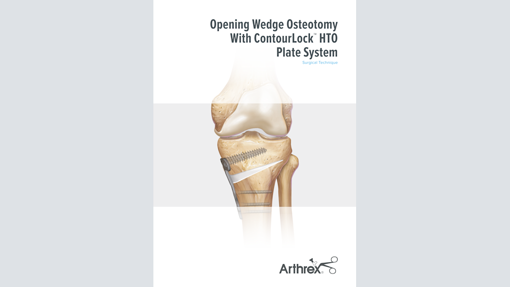 Arthrex Opening Wedge Osteotomy Instrument Set