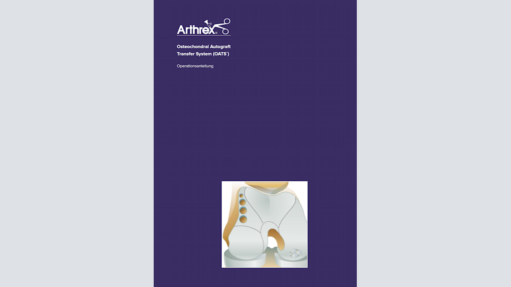 Arthrex - Autograft OATS®