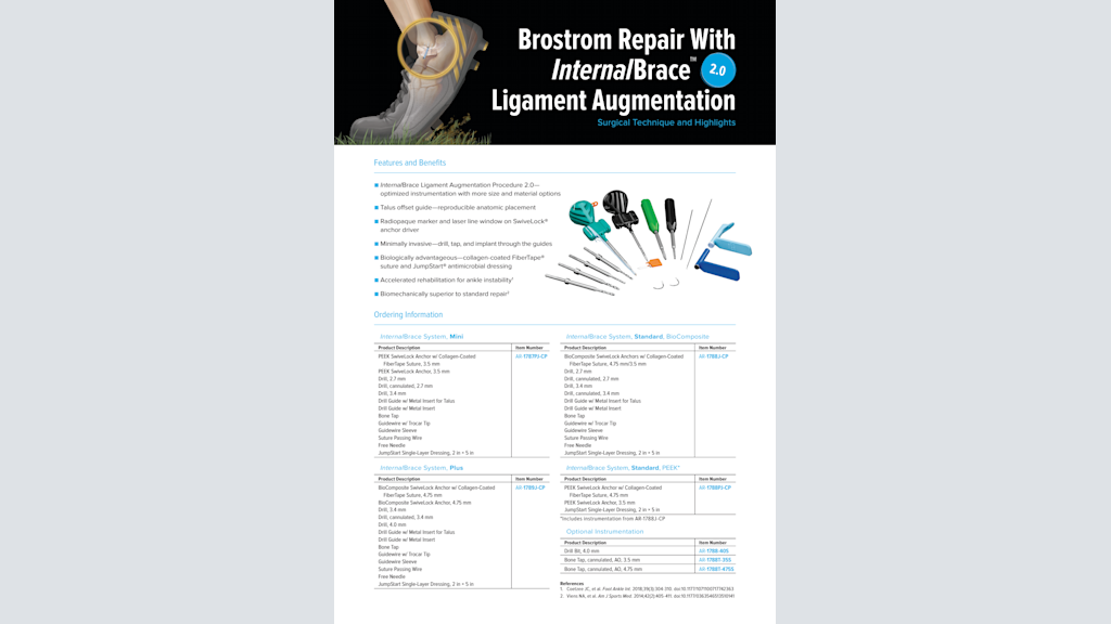 Arthrex - Técnica de reparación de Brostrom con InternalBrace™