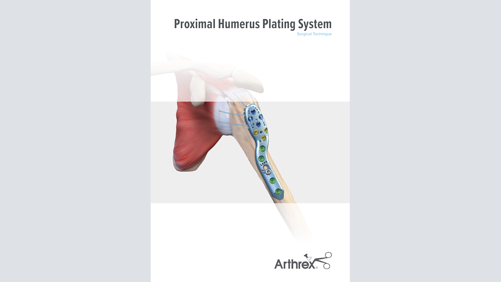 Proximal Humerus Plating System