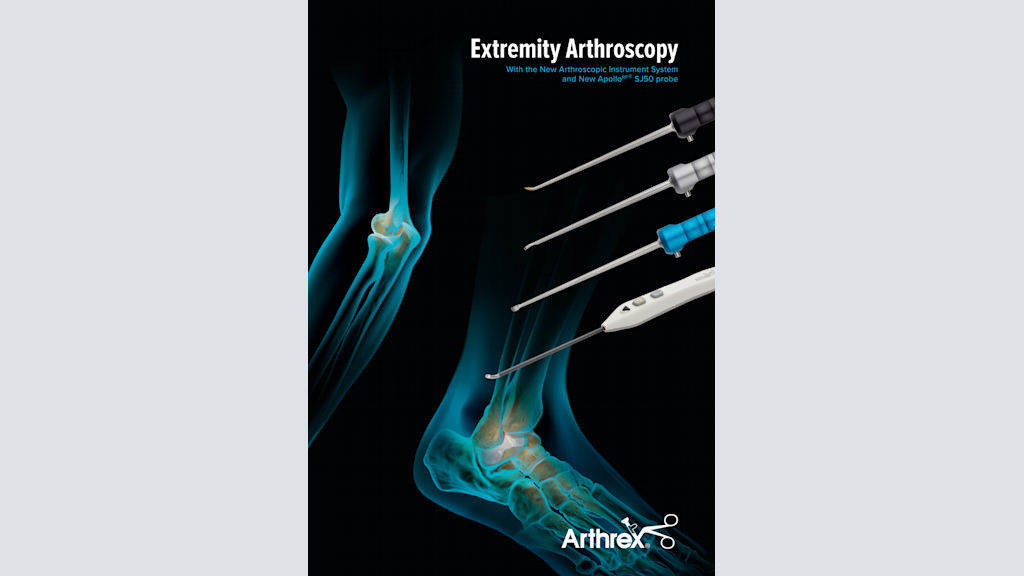 Extremity Arthroscopy With the New Arthroscopic Instrument System and New ApolloRF® SJ50 probe