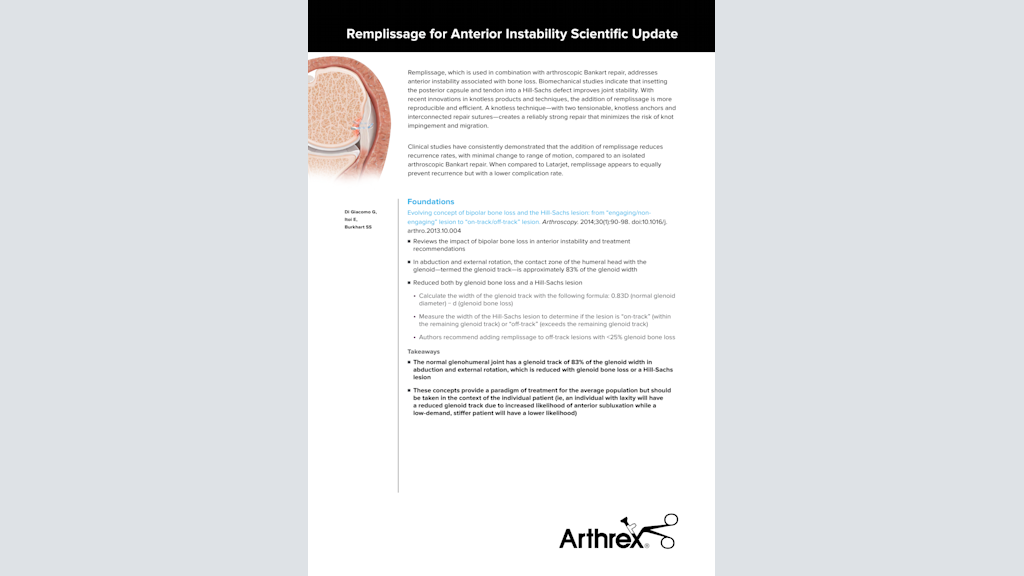 Remplissage for Anterior Instability Scientific Update