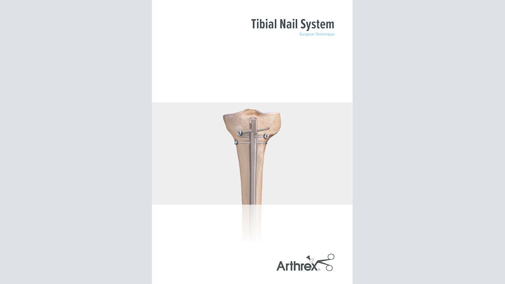 Tibial Nail System