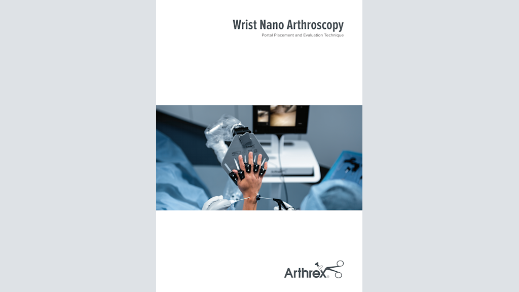 Wrist Nano Arthroscopy Portal Placement and Evaluation Technique