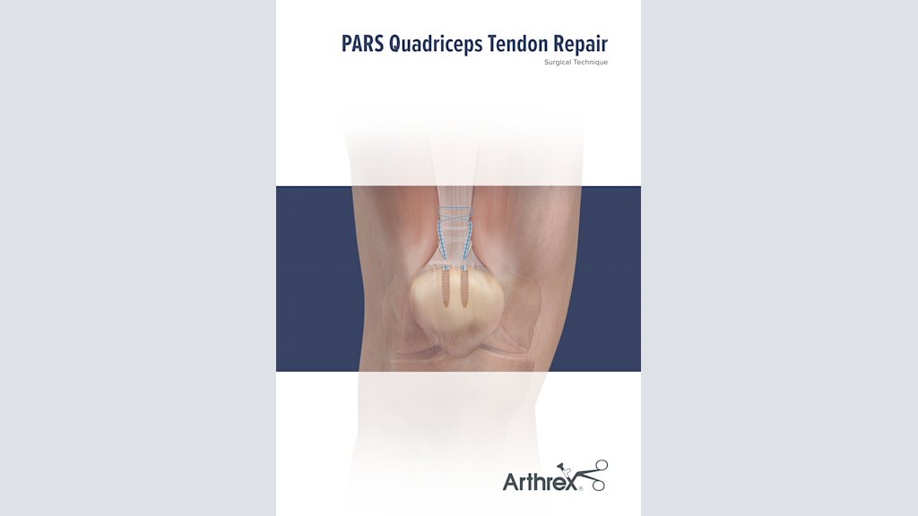 PARS Quadriceps Tendon Repair