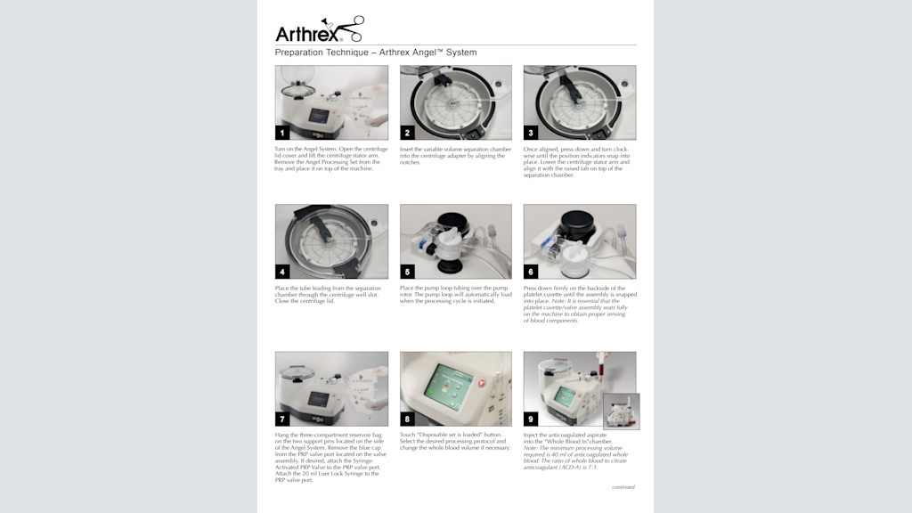 Preparation Technique- Arthrex Angel™ System