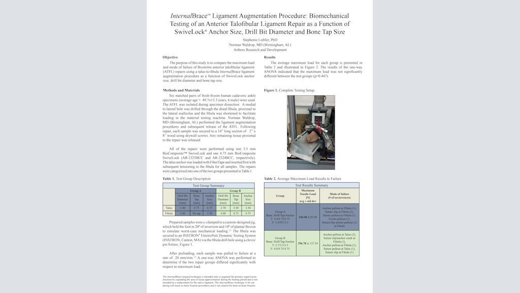 InternalBrace™ Ligament Augmentation Procedure: Biomechanical Testing of an Anterior Talofibular Ligament Repair as a Function of SwiveLock® Anchor Size, Drill Bit Diameter and Bone Tap Size