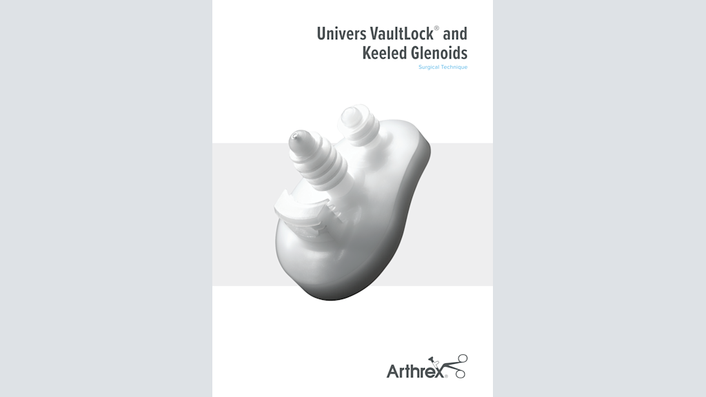 Univers VaultLock® and Keeled Glenoids