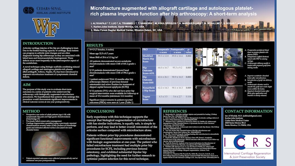 Microfracture augmented with allograft cartilage and autologous platelet-rich plasma improves function after hip arthroscopy: A short-term analysis