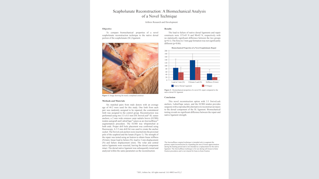 Scapholunate Reconstruction: A Biomechanical Analysis of a Novel Technique