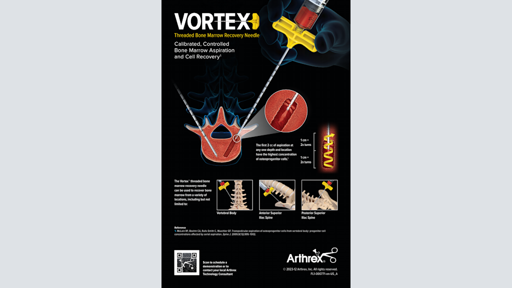 Vortex Threaded Bone Marrow Recovery Needle - Calibrated, Controlled Bone Marrow Aspiration and Cell Recovery