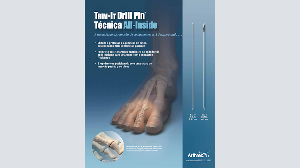 Trim-It Drill Pin® - Técnica All-Inside