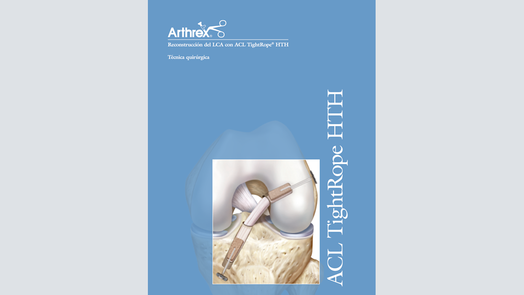 Reconstrucción del LCA con ACL TightRope® HTH