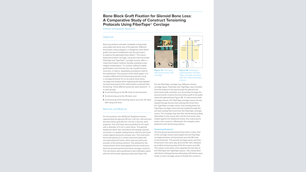 Bone Block Graft Fixation for Glenoid Bone Loss: A Comparative Study of Construct Tensioning Protocols Using FiberTape® Cerclage