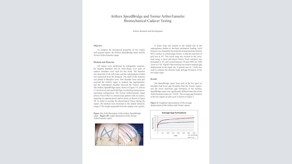 Arthrex SpeedBridge™ and Tornier ArthroTunneler Biomechanical Cadaver Testing