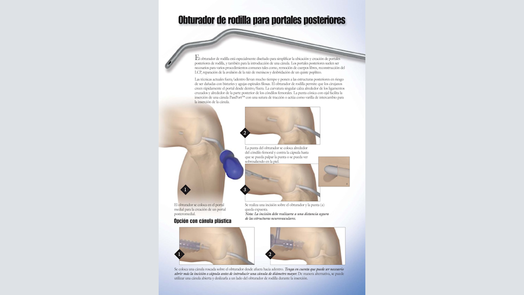 Obturador de Rodilla para Portales Posteriores