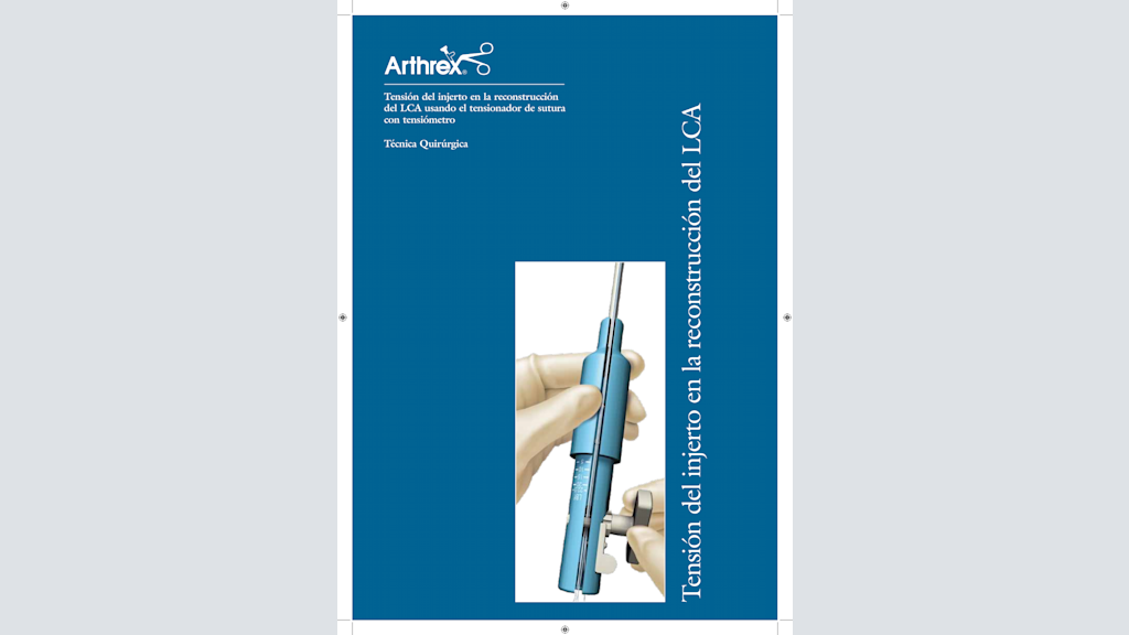 Tensión del injerto en la reconstrucción del LCA usando el tensionador de sutura con tensiómetro
