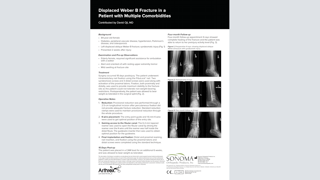 Displaced Weber B Fracture in a Patient with Multiple Comorbidities