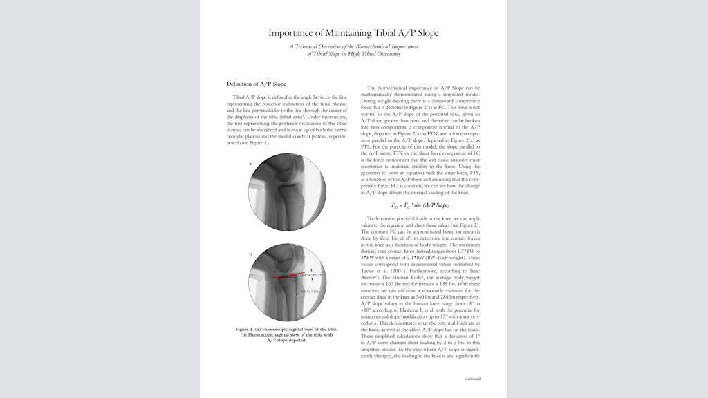 Importance of Maintaining Tibial A/P Slope A Technical Overview of the Biomechanical Importance of Tibial Slope in High Tibial Osteotomy