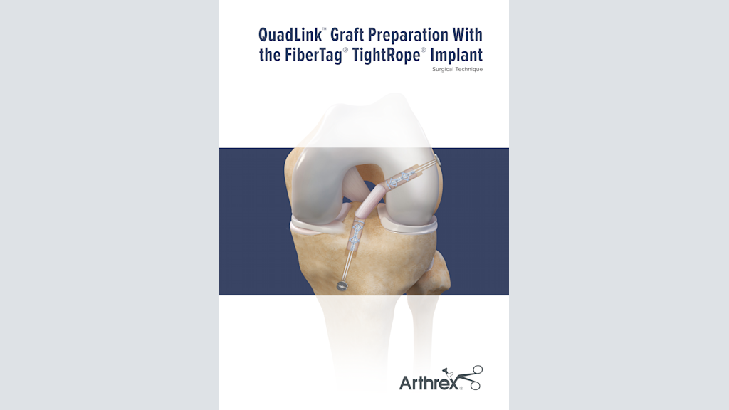 Arthrex - FiberTag® TightRope® Implant
