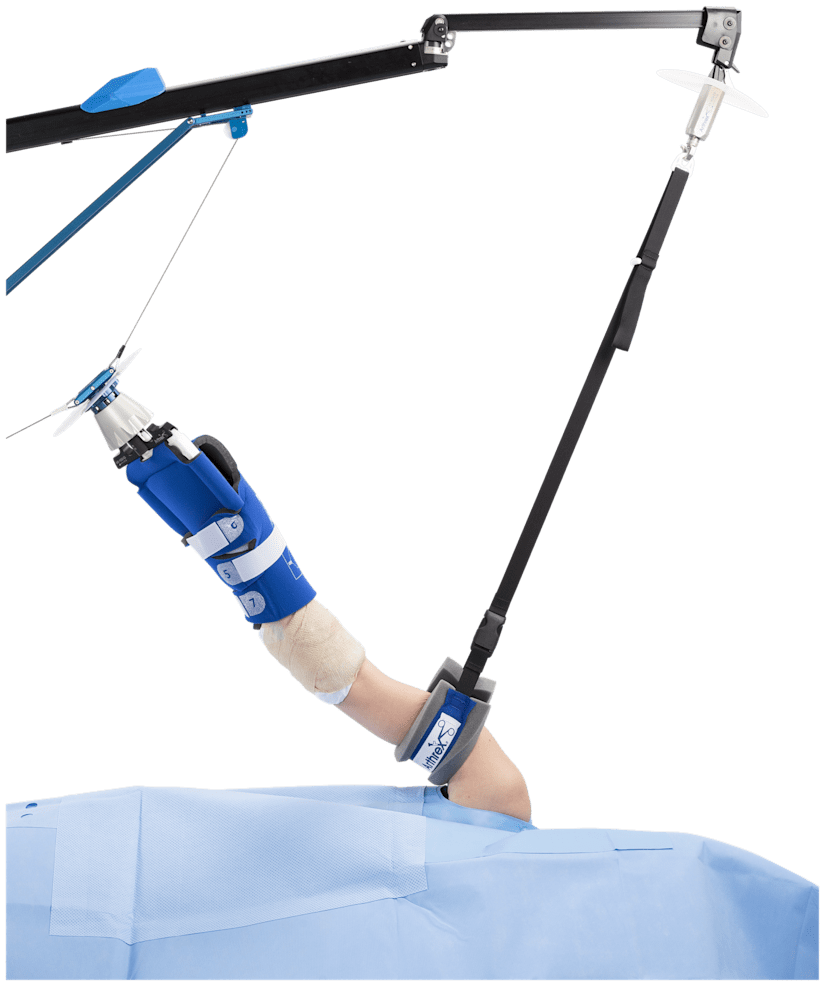 Shoulder Suspension System (S3) (Includes: Tower, US Clark Rail Clamp, one Arm Sleeve Connector, one Lateral Traction Sleeve Connector, Weight Hanger and five weights)