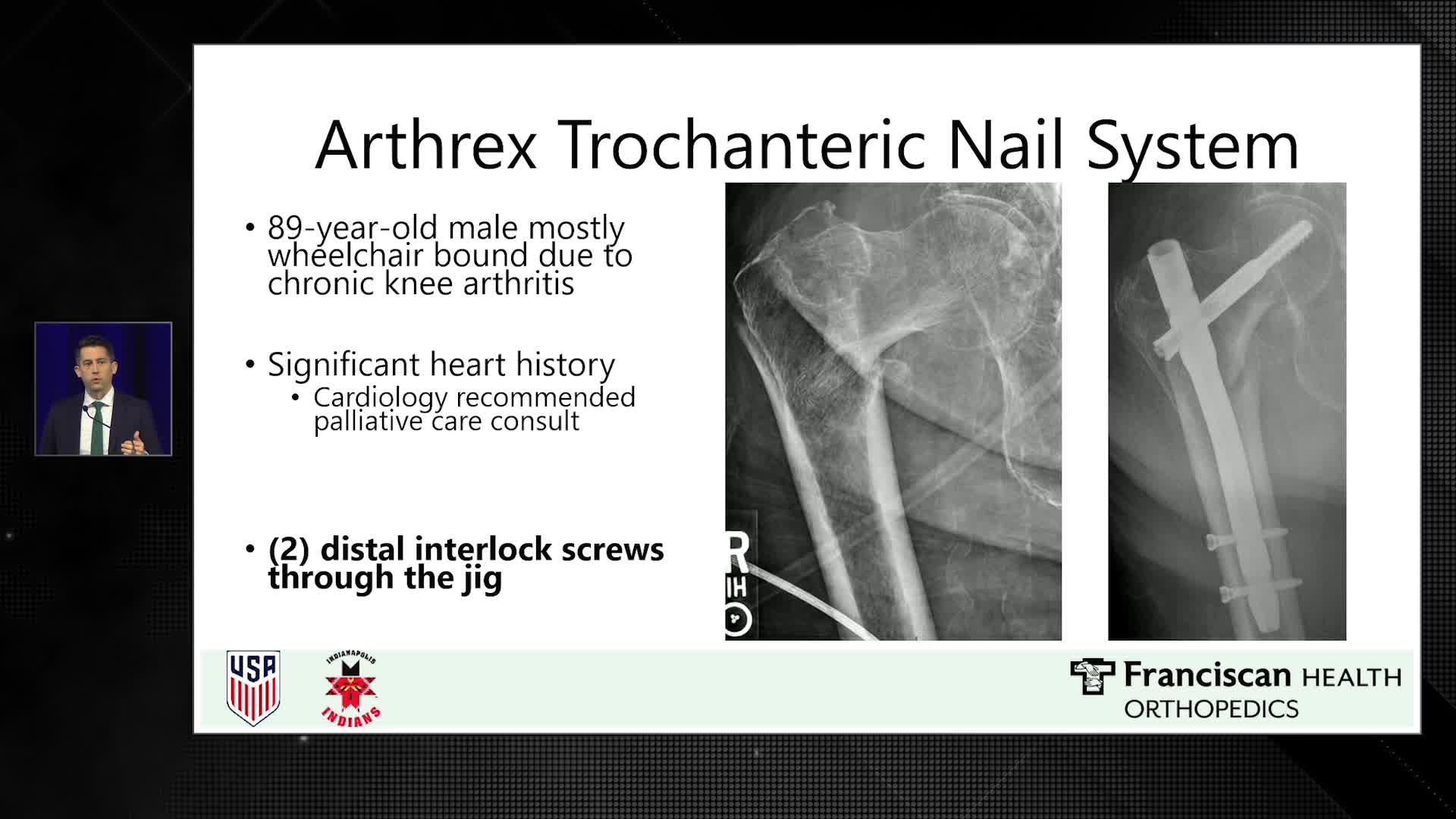 Arthrex Sports Medicine Fellowship Forum 2024 Surviving Call