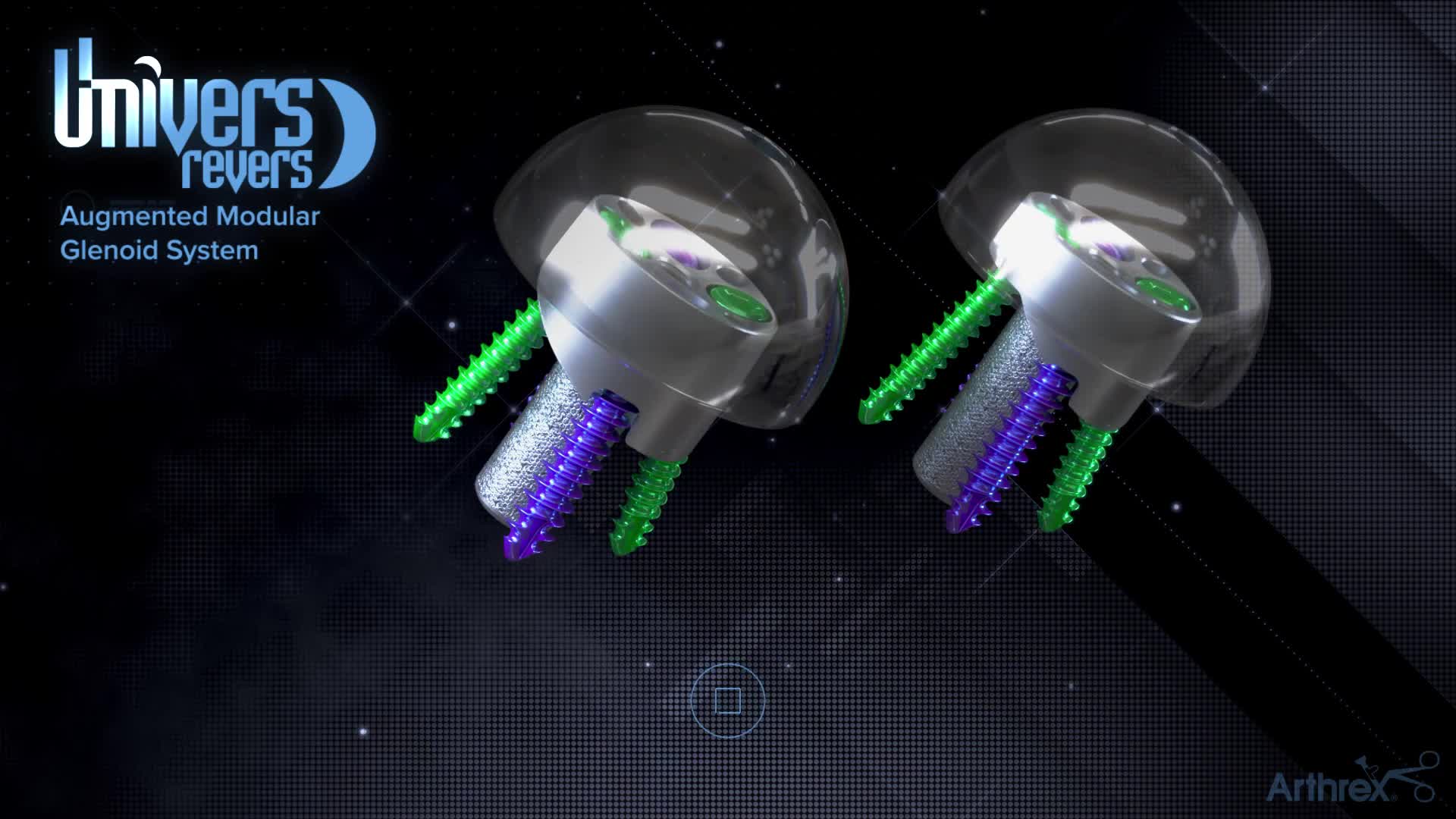 Arthrex - Univers Revers™ Augmented Modular Glenoid System