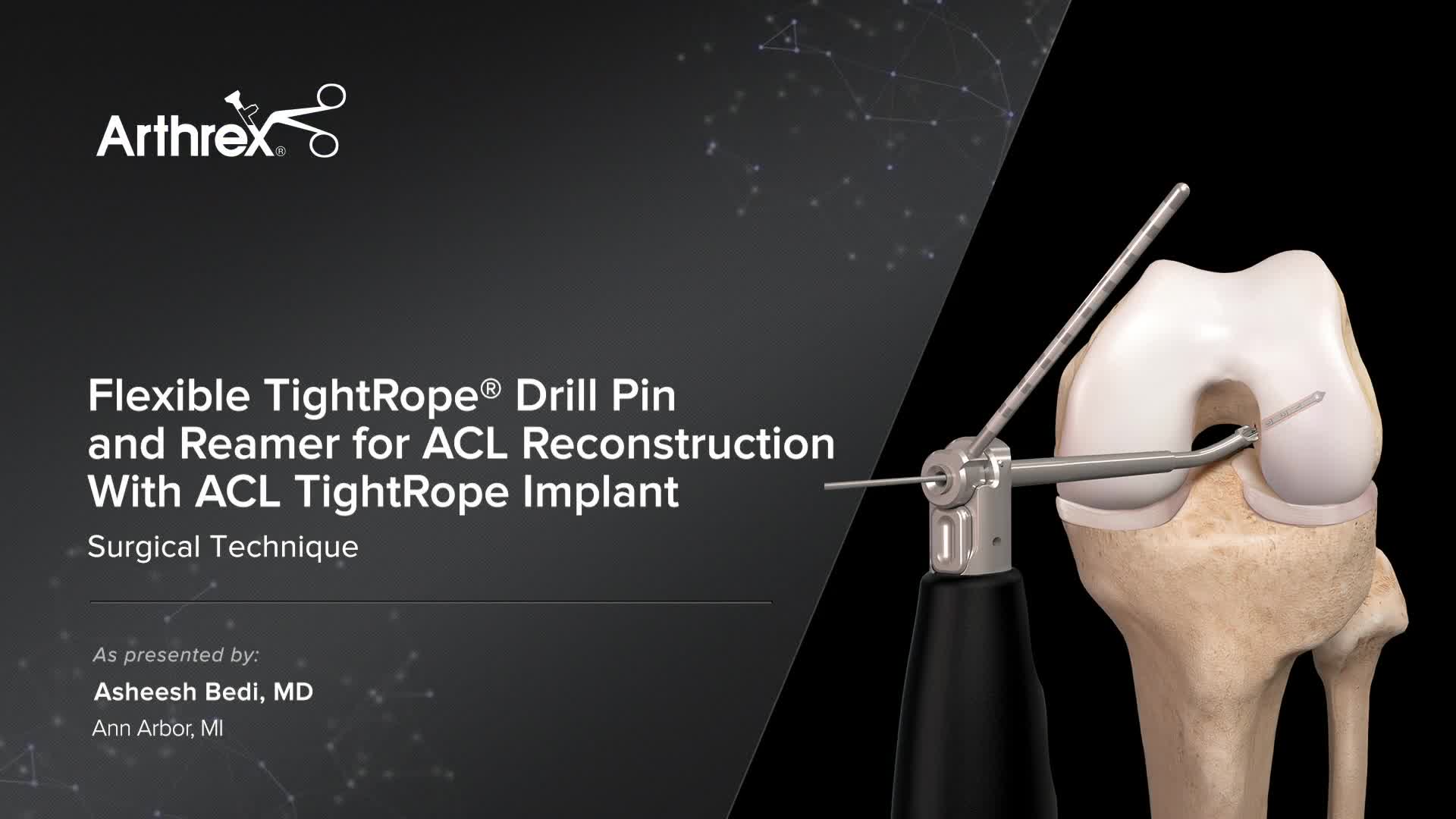 Arthrex Flexible TightRope® Drill Pin and Reamer for ACL
