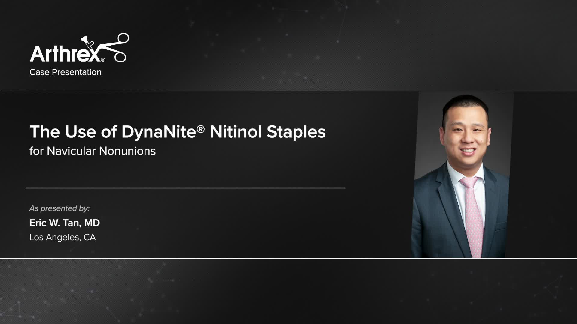 Arthrex DynaNite® Nitinol Staples for Navicular Nonunion Augmented