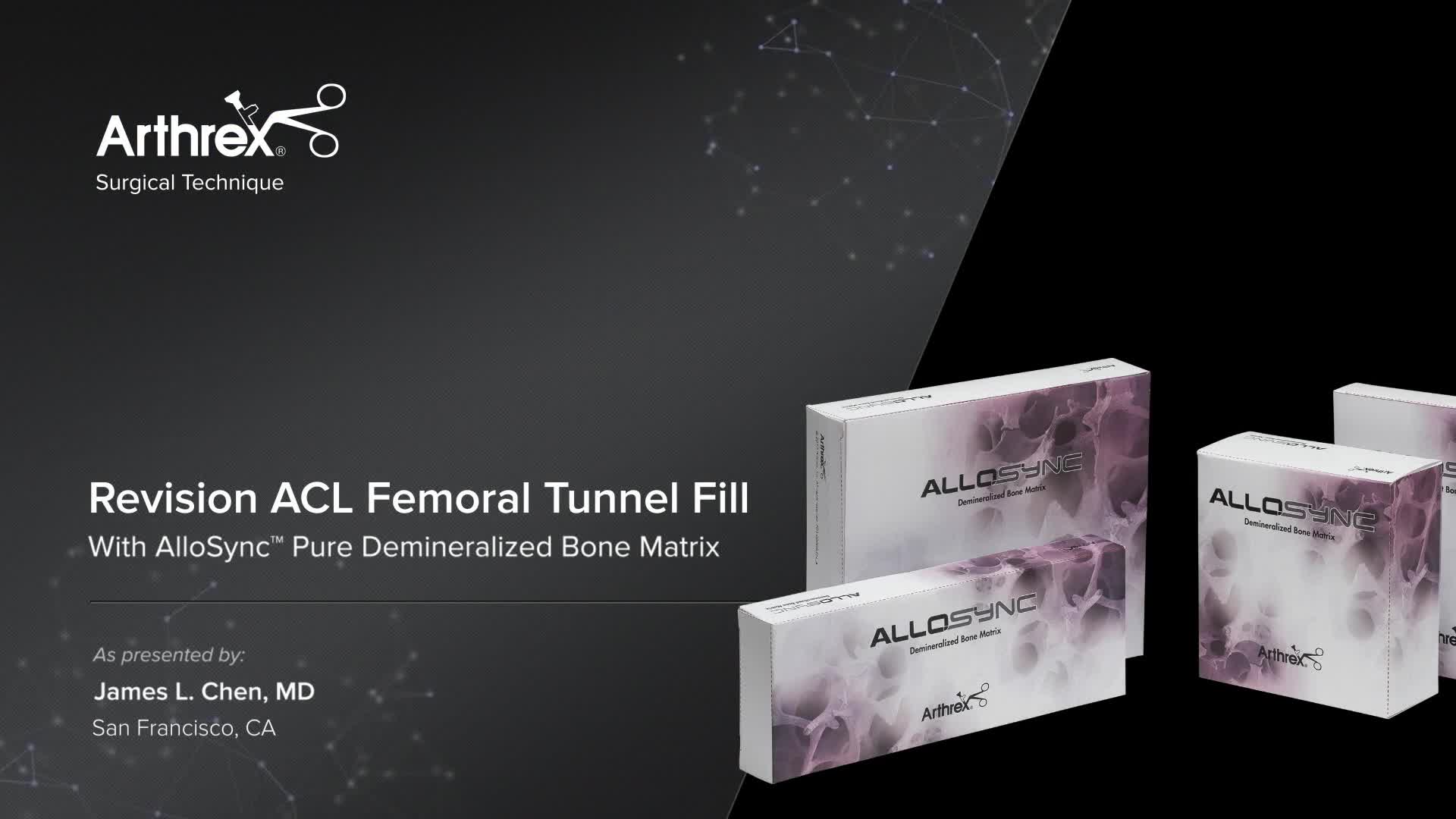 Arthrex - Revision ACL Femoral Tunnel Fill With AlloSync™ Pure ...