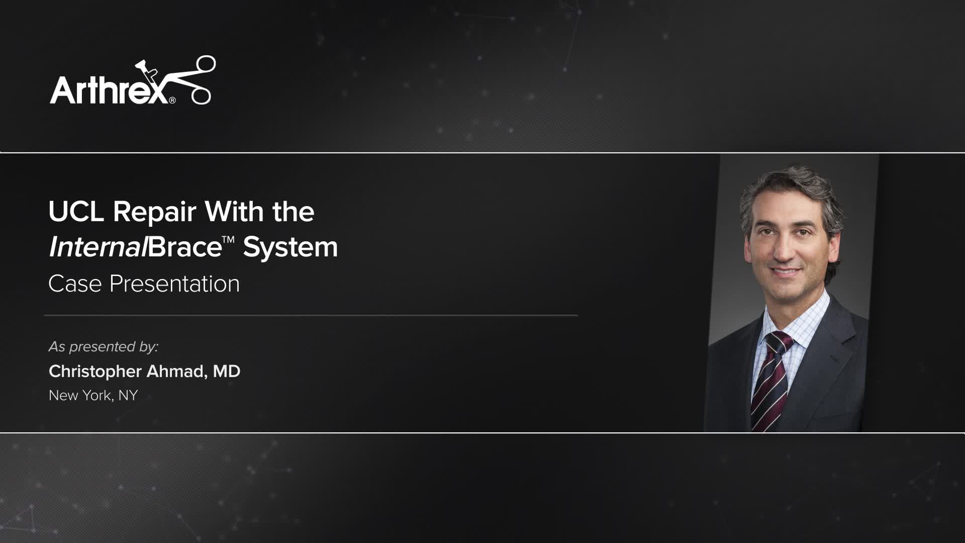 Arthrex UCL Repair With the InternalBrace™ System