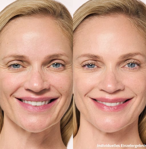 AGE EFFECT Model B/A