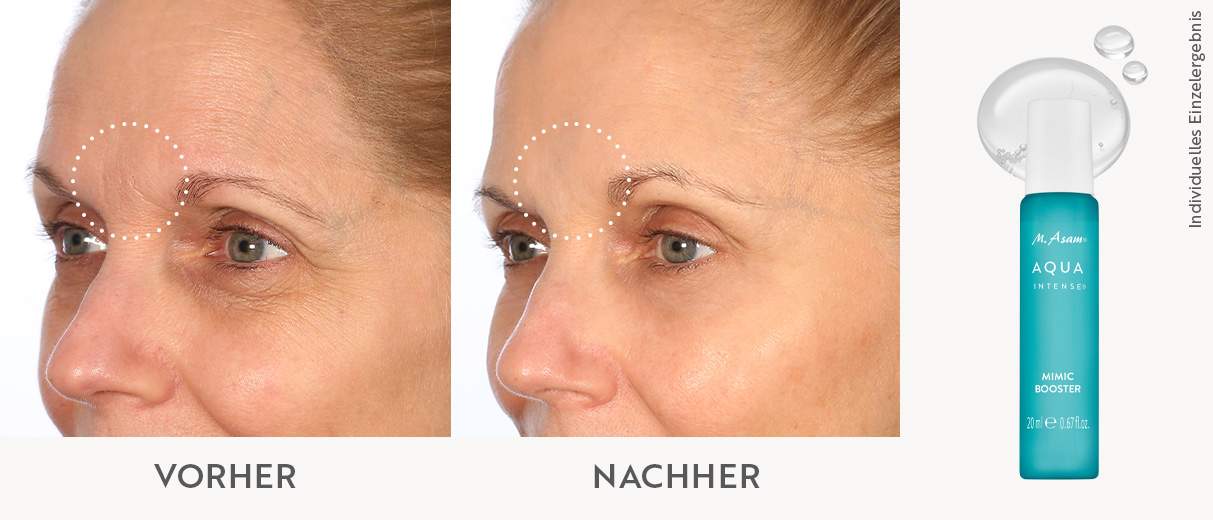 Vorher-Nachher-Foto einer Frau nach Anwendung des Aqua Intense Mimic Booster Serum von M.Asam