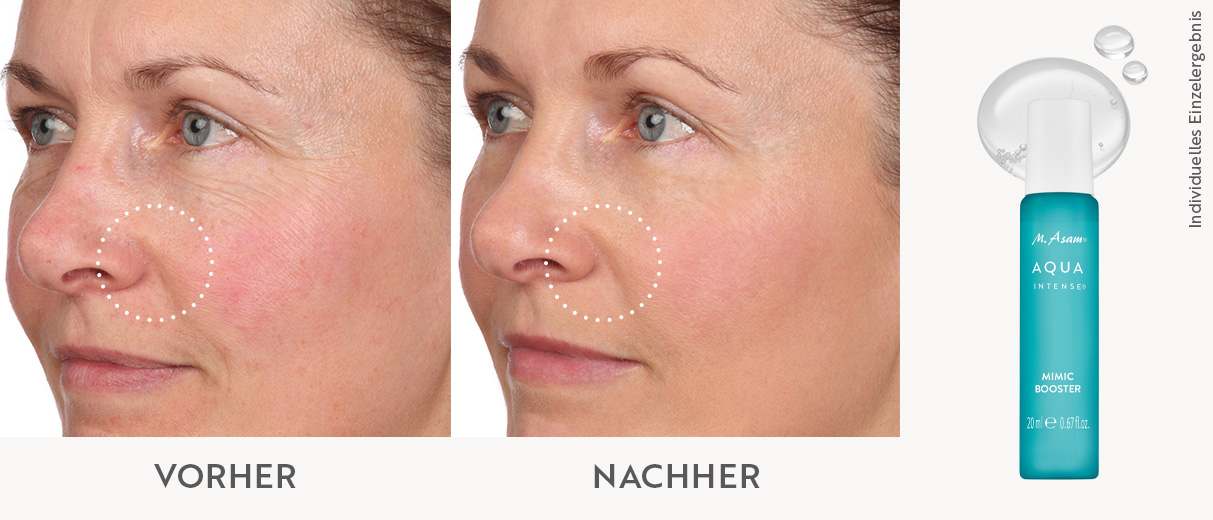 Vorher-Nachher-Foto einer Frau nach Anwendung des Aqua Intense Mimic Booster Serum von M.Asam