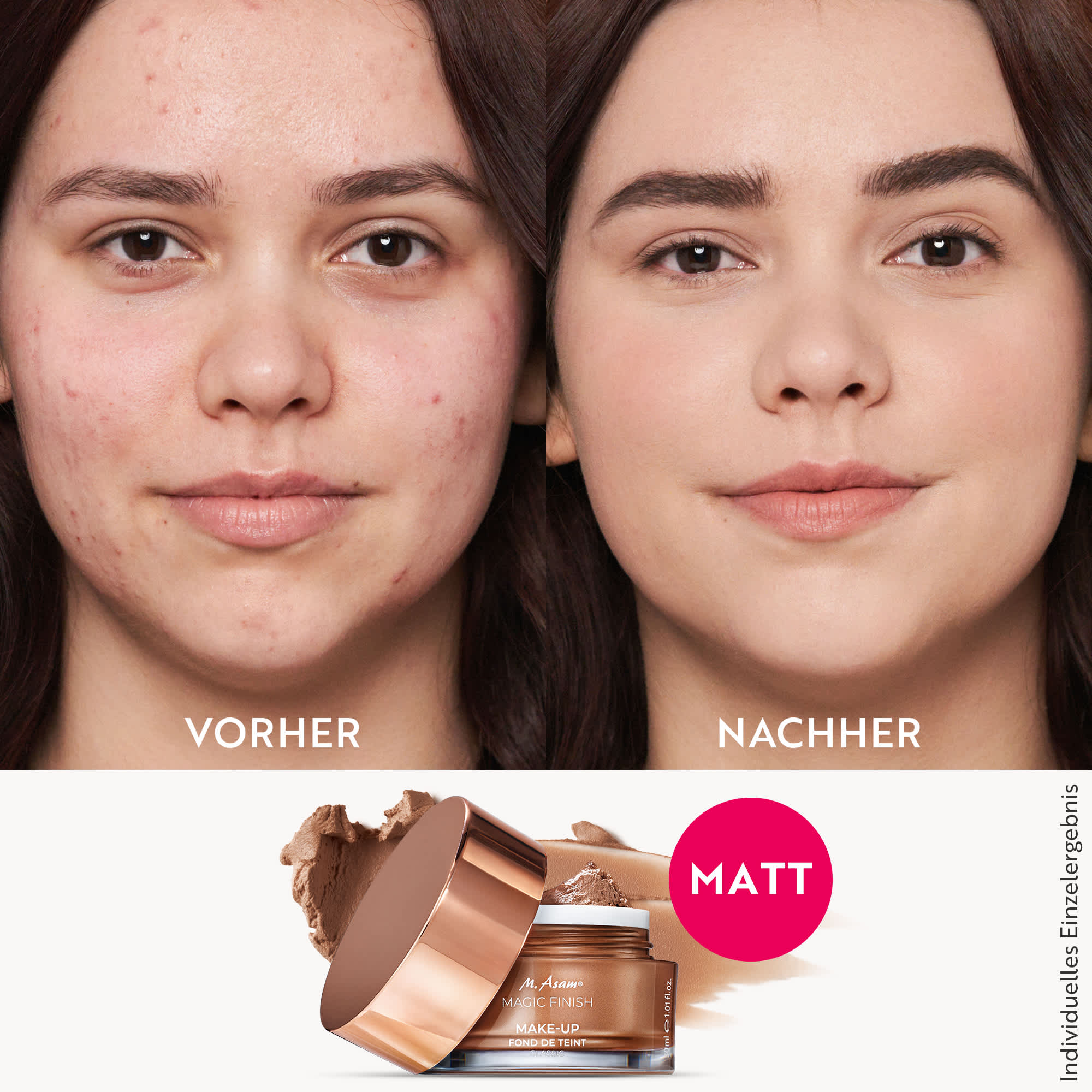 Beauty-Porträt Vorher-Nachher mit M. Asam MAGIC FINISH Mousse