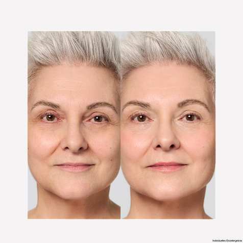 M. Asam VINOLIFT Straffendes Gesichts- & Augenpflege Set 4-teilig