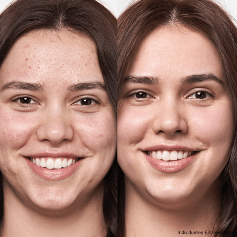 M. Asam CLEAR SKIN Reine Haut Kennenlern Gesichtspflege Routine 4-teilig