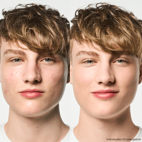 M. Asam CLEAR SKIN Reine Haut Kennenlern Gesichtspflege Routine 4-teilig