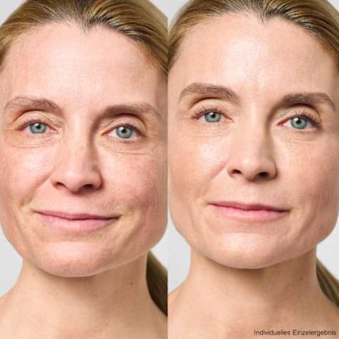 M. Asam AQUA INTENSE Supreme Hyaluron Gesichtscreme