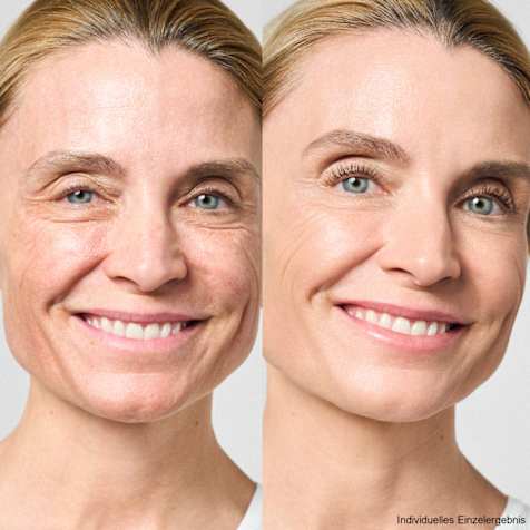 M. Asam AQUA INTENSE Getönte Hyaluron Tagescreme