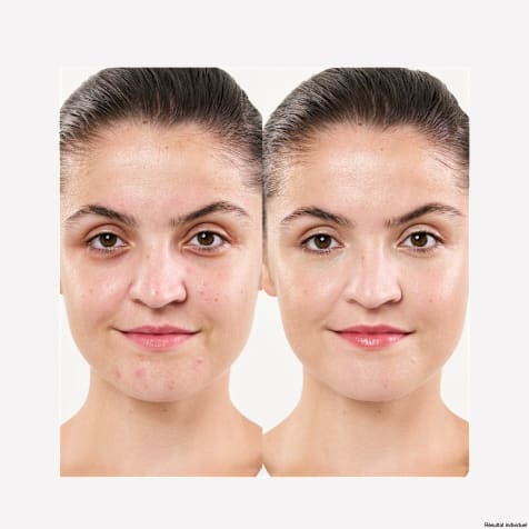 M. Asam CLEAR SKIN Peeling aux Enzymes de Fruits