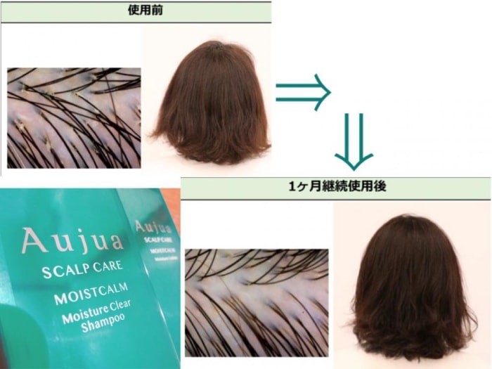 地肌の悩みを改善してかゆみ フケのない本来の髪へ コラム Ash 大泉学園店 横山 直輝 Ash オフィシャルサイト 地肌の悩みを改善してかゆみ フケのない本来の髪へ コラム Ash 大泉学園店 横山 直輝 Ash オフィシャルサイト