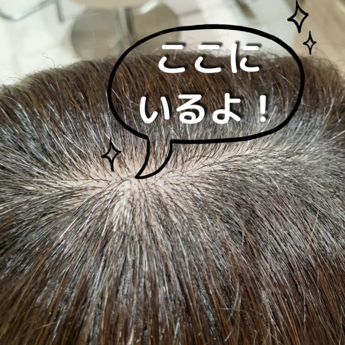 頭皮