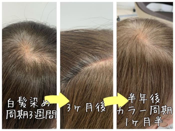 脱白髪染めのその後 白髪が気にならないのはウソ 脱白髪染めの過程とその後お見せします コラム Ash 高円寺店 星野 玲奈 Ash オフィシャルサイト 脱白髪染めのその後 白髪が気にならないのはウソ 脱白髪染めの過程とその後お見せします コラム Ash 高円寺店 星野 玲奈 Ash オフィシャルサイト