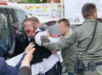 השהיית השוטרים אשר פגעו בילד המיוחד
