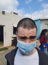 הצלת שיער הראש של יואבגל