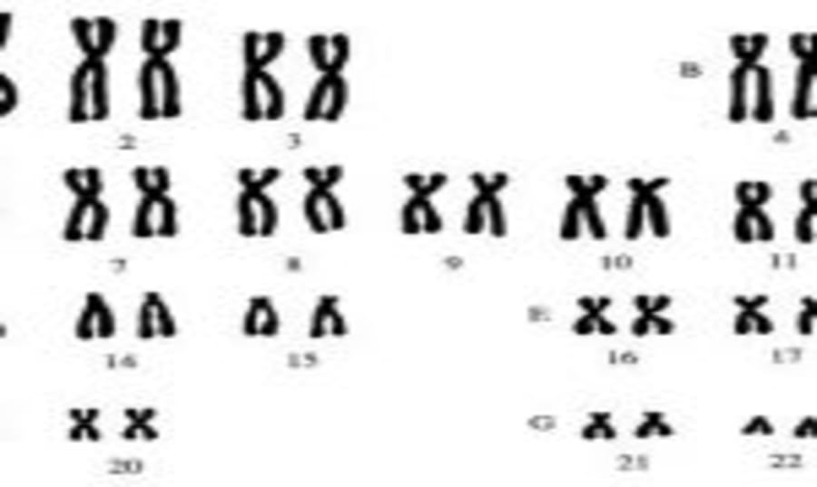 what-is-the-cost-of-karyotyping-test-in-india Image