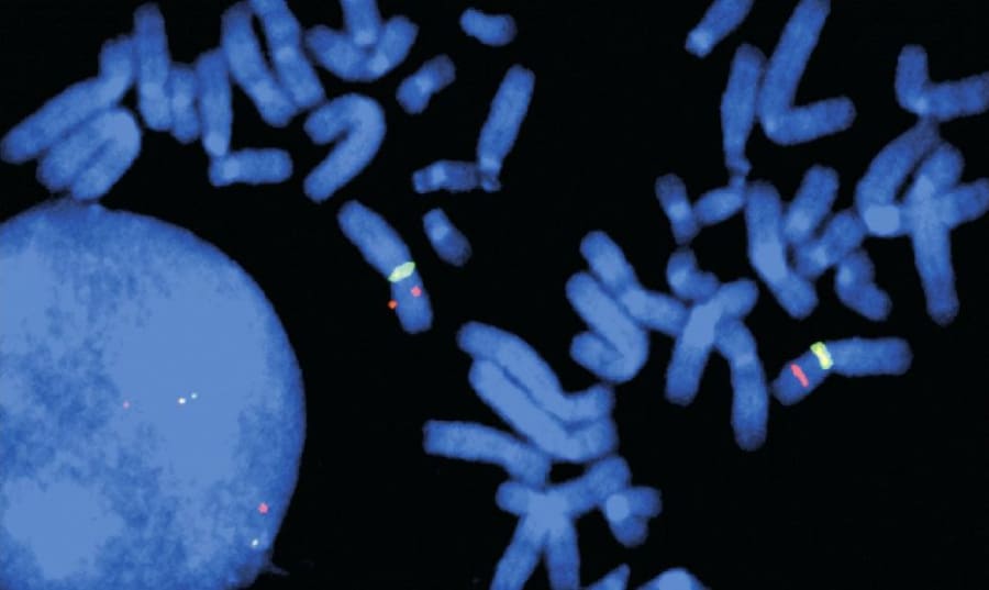 fluorescence in situ hybridization down syndrome