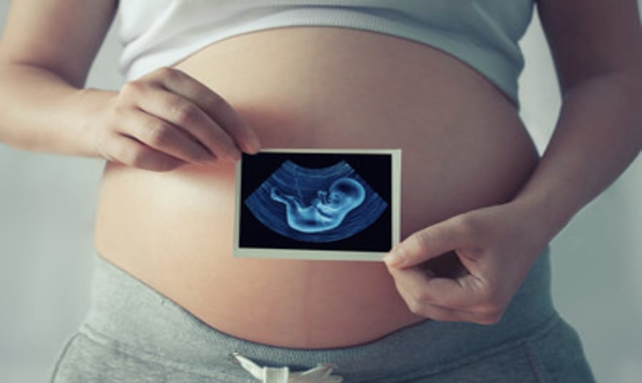 6-week-pregnancy-ultrasound Image