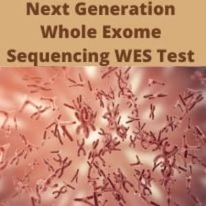 Whole Exome Sequencing + Chromosomal Microarray